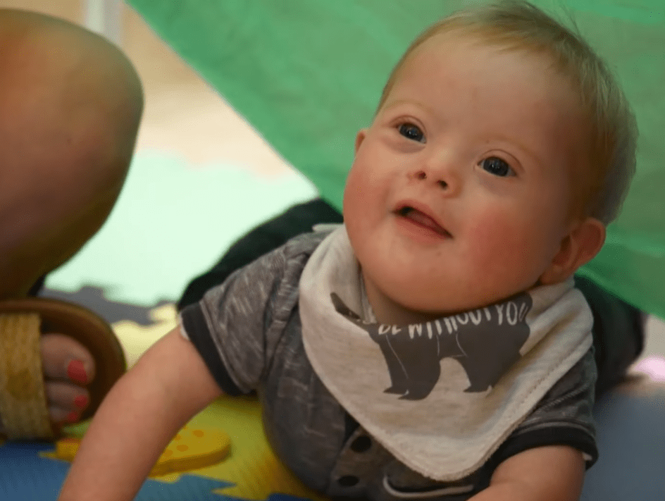 What is Down’s Syndrome? | Downs Syndrome Scotland